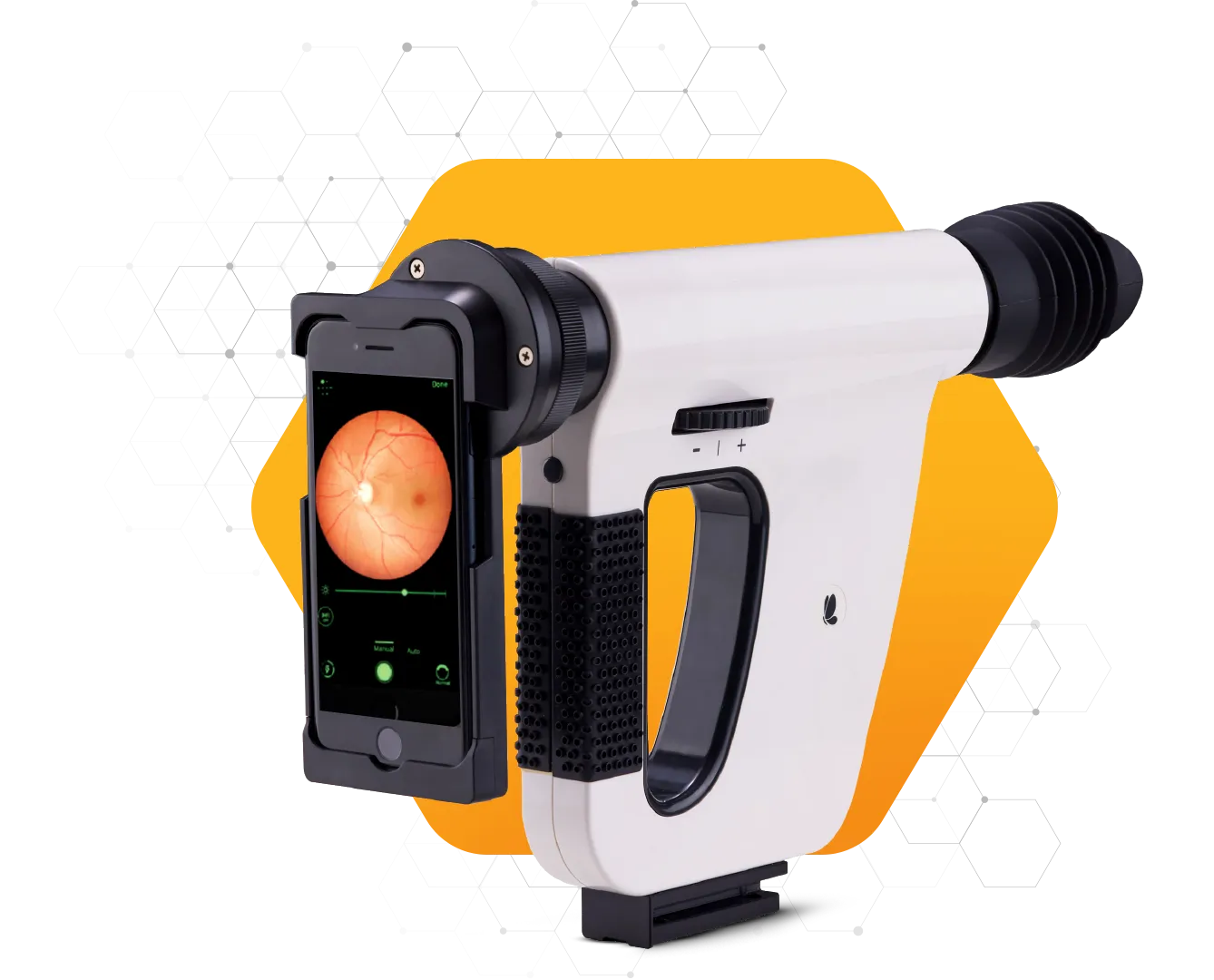 Fundus on Phone device for AI-enabled eye screening